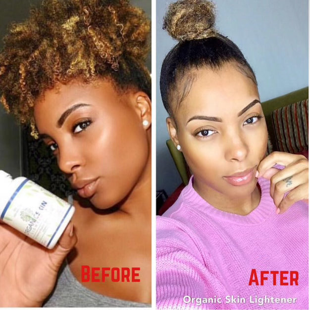 Organic Skin Lightener Starter Kit 6 Months Supply